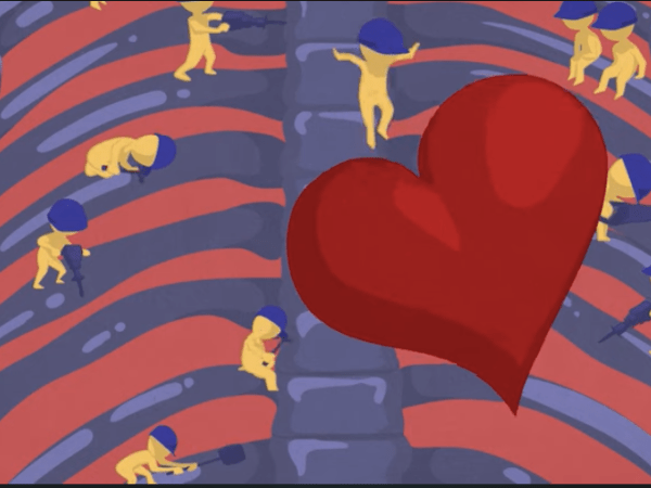 Une vidéo de sensibilisation à la douleur dans&nbsp;l&rsquo;OI